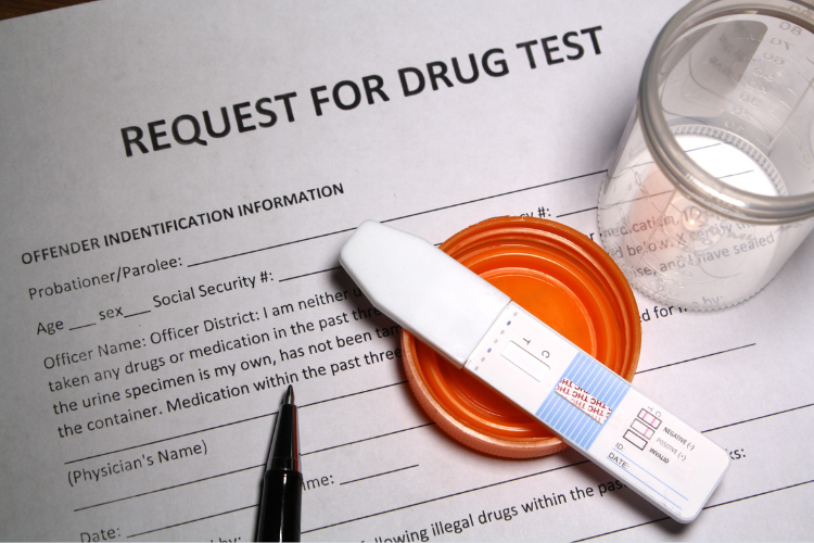 test narkoba biasanya dibutuhkan untuk berbagai keperluan, salah satunya untuk melamar pekerjaan 
