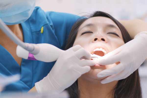 scaling gigi di rolas dentalcare