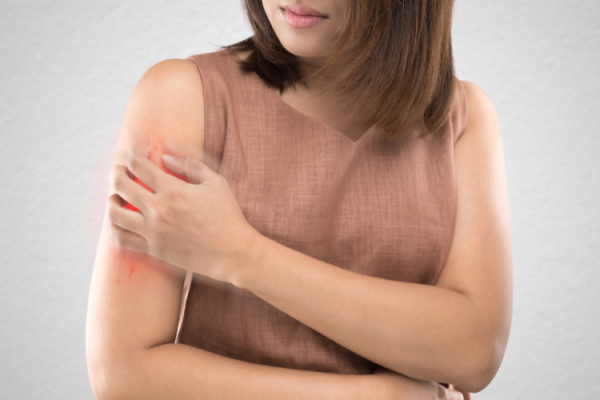 Read more about the article Kenali 6 Jenis Psoriasis, Penyebab serta Gejalanya